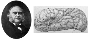 Paul Broca on left and sketch of brain with aphasia on right