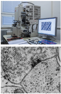 upper portion depicts electron microscope and lower portion depicts synapse between two neurons