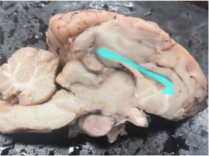 A midsagittal section of the sheep brain with the corpus callosum highlighted in cyan.