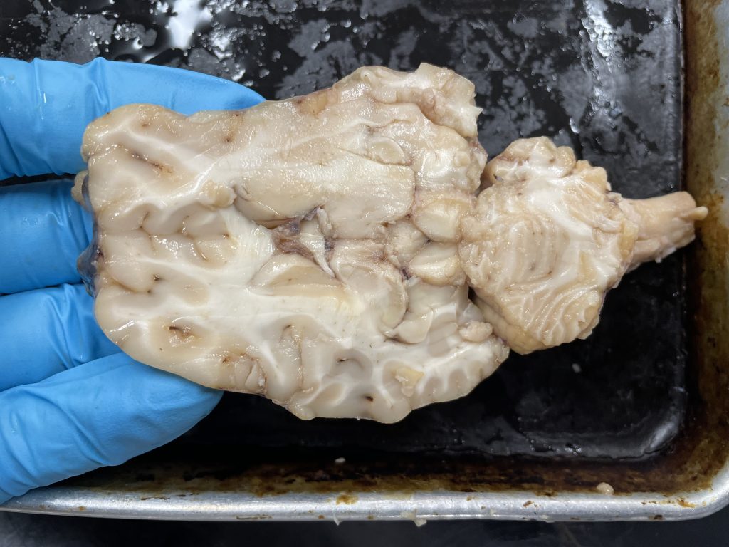 horizontal slice of sheep brain - horizontal slice 1