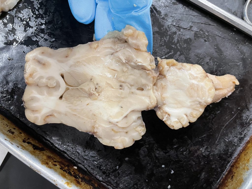 horizontal slice of sheep brain - horizontal slice 2