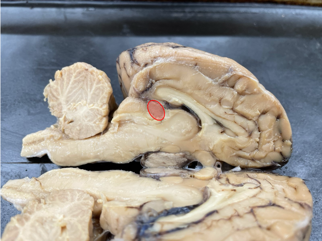 midsagittal view of sheep brain with pineal gland indicated