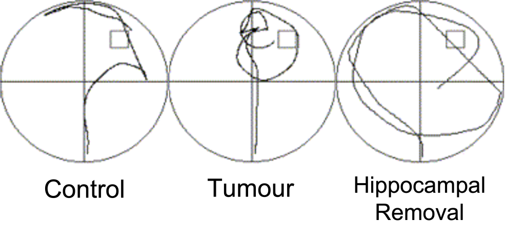 Three circles labelled as “Control (left)”, “Tumour (centre)”, and “Hippocampal Removal (right)”. In the Control circle, the line is pointed toward the swim platform with the most time spent in the correct quadrant. The Tumour line circles around the platform multiple times. The Hippocampal Removal line is random and crosses into every quadrant equally.