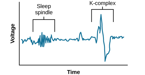 A graph has an x-axis labeled “time” and a y-axis labeled “voltage. A line illustrates brainwaves, with two areas labeled “sleep spindle” and “k-complex”. The area labeled “sleep spindle” has decreased wavelength and moderately increased amplitude, while the area labeled “k-complex” has significantly high amplitude and longer wavelength