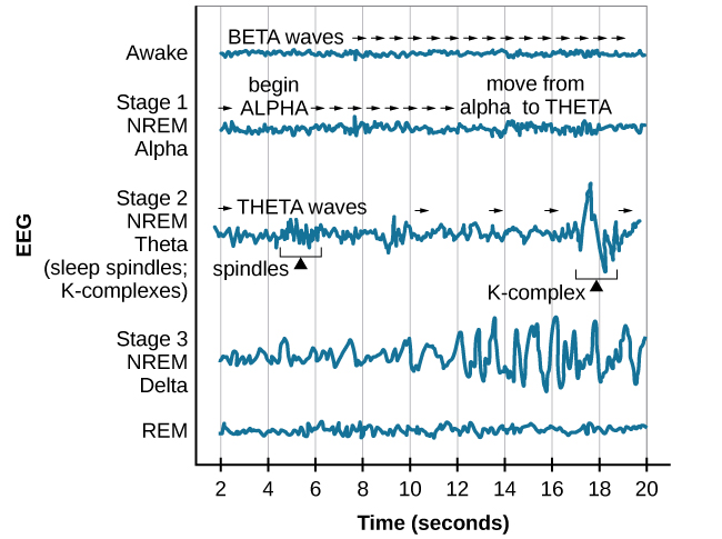 A graph has a y-axis labeled “EEG” and an x-axis labeled “time (seconds.) Plotted along the y-axis and moving upward are the stages of sleep. First is REM, followed by Stage 3 NREM Delta, Stage 2 NREM Theta (sleep spindles; K-complexes), Stage 1 NREM Alpha, and Awake. Charted on the x axis is Time in seconds from 2–20 in 2 second intervals. Each sleep stage has associated wavelengths of varying amplitude and frequency. Relative to the others, “awake” has a very close wavelength and a medium amplitude. Stage 1 is characterized by a generally uniform wavelength and a relatively low amplitude which doubles and quickly reverts to normal every 2 seconds. Stage 2 is comprised of a similar wavelength as stage 1. It introduces the K-complex from seconds 10 through 12 which is a short burst of doubled or tripled amplitude and decreased wavelength. Stage 3 has a more uniform wave with gradually increasing amplitude. Finally, REM sleep looks much like stage 2 without the K-complex.