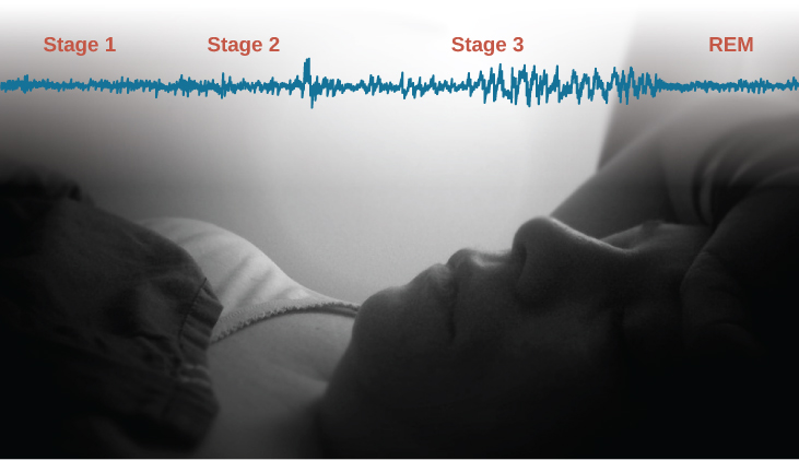 A photograph shows a person sleeping. Superimposed across the top of the picture is a line representing brainwave activity across the four stages of sleep. Above the line, from left to right, it reads stage 1, stage 2, stage 3, and stage 4. The wave amplitude is highest in late stage 2, and in the middle of stage 3 until stage 4. The wavelength is longer from late stage 2 through stage 3.